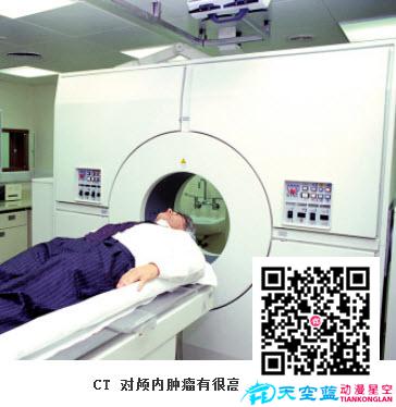 CT能檢查什么??？.jpg