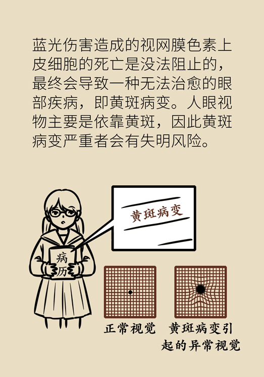 防藍光眼睛保護是怎么回事？
