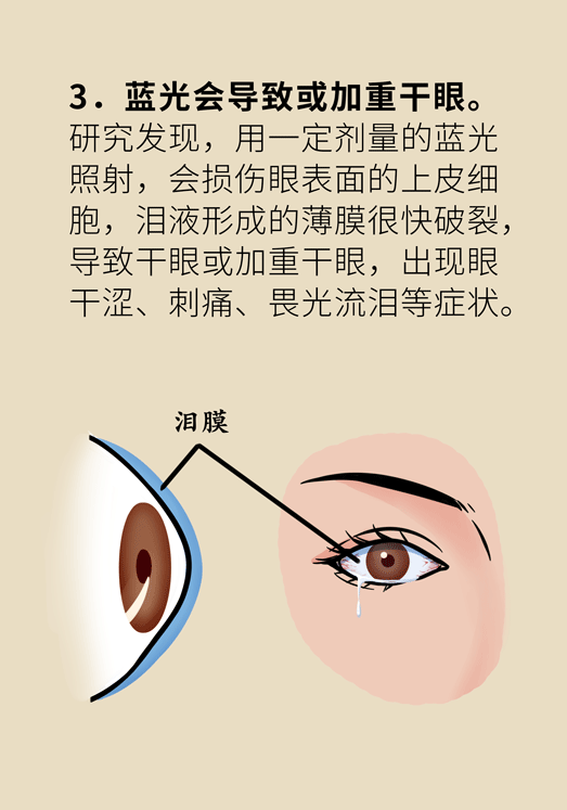 防藍光眼睛保護是怎么回事？