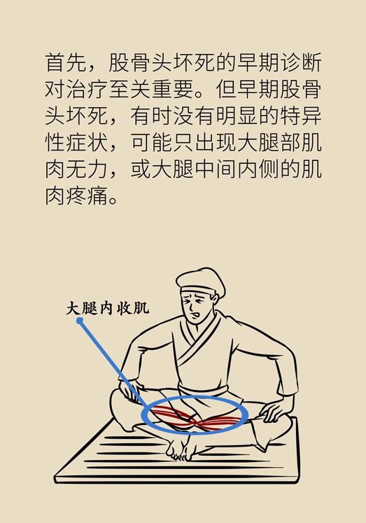 激素會帶來股骨頭壞死的后遺癥嗎？