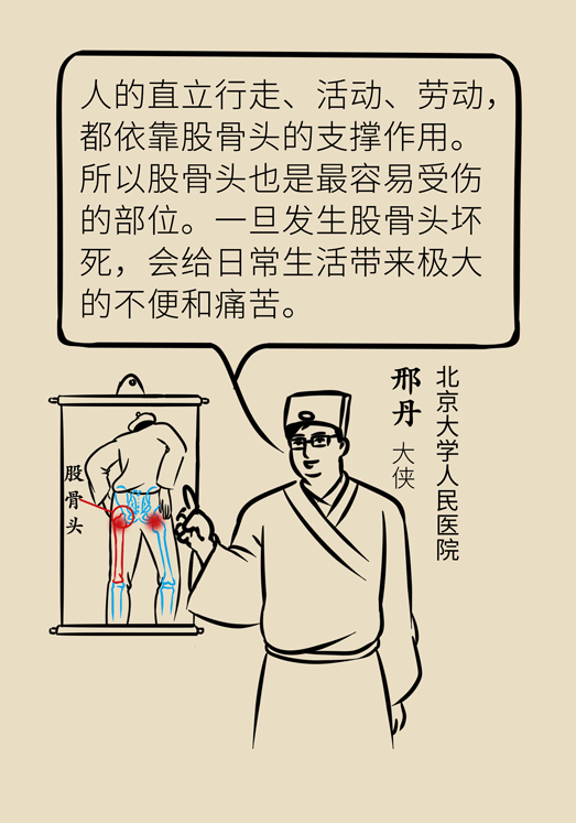 激素會帶來股骨頭壞死的后遺癥嗎？