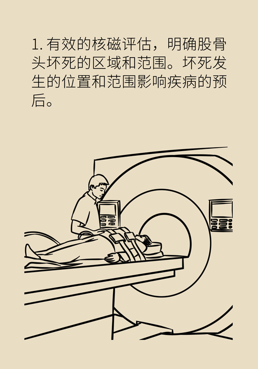 激素會帶來股骨頭壞死的后遺癥嗎？