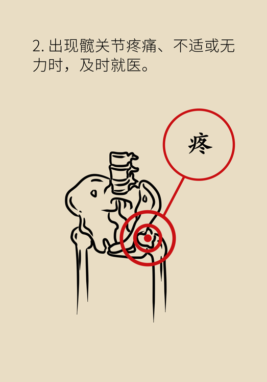 激素會帶來股骨頭壞死的后遺癥嗎？