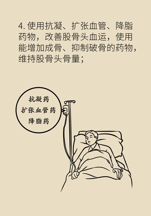 激素會帶來股骨頭壞死的后遺癥嗎？