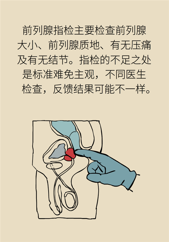 前列腺肥大了還能縮小嗎？