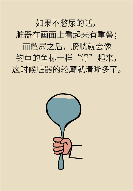 前列腺肥大了還能縮小嗎？