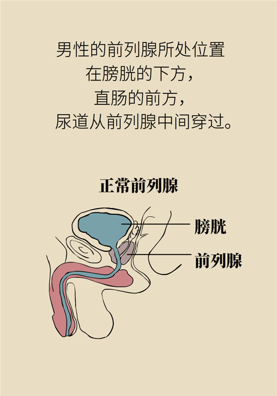 前列腺肥大了還能縮小嗎？