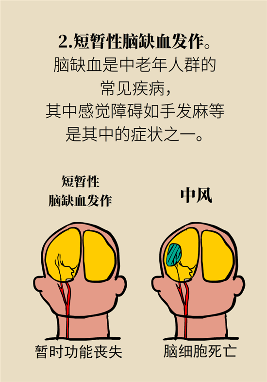 無緣無故的手麻，這是身體發(fā)出的什么信號？