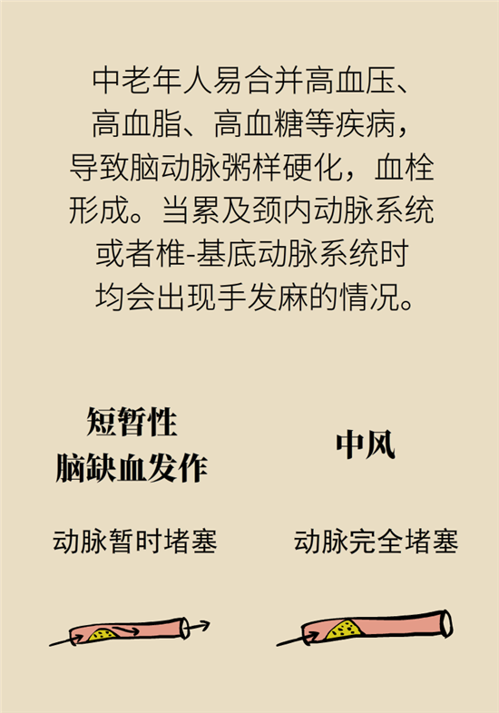 無緣無故的手麻，這是身體發(fā)出的什么信號？