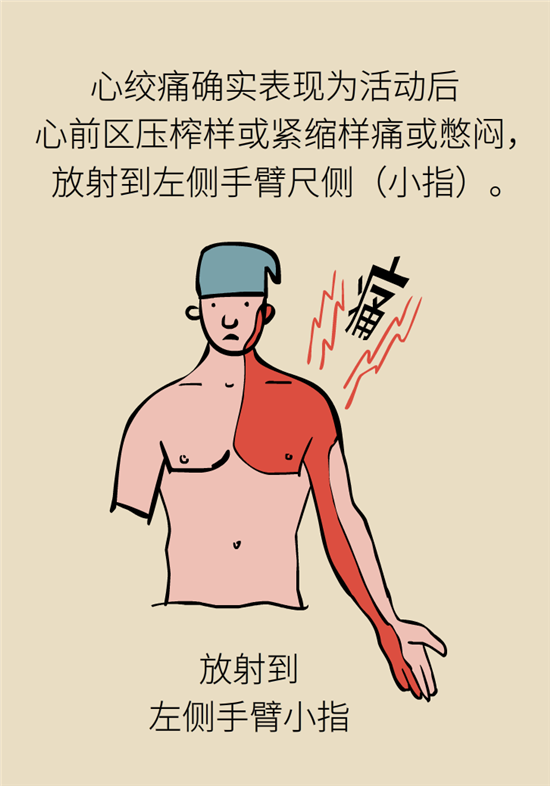 什么是冠心病，這些疼痛可能是心絞痛！