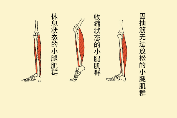 為什么缺鈣會導(dǎo)致抽筋？