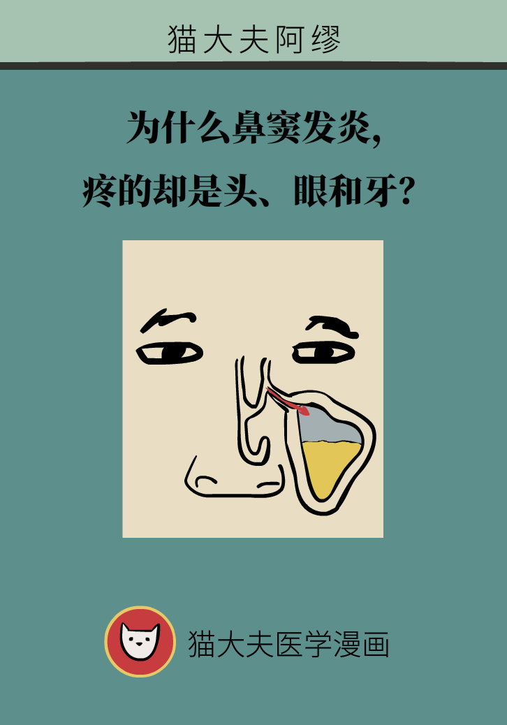 為什么鼻竇發(fā)炎，疼的卻是頭、眼和牙？