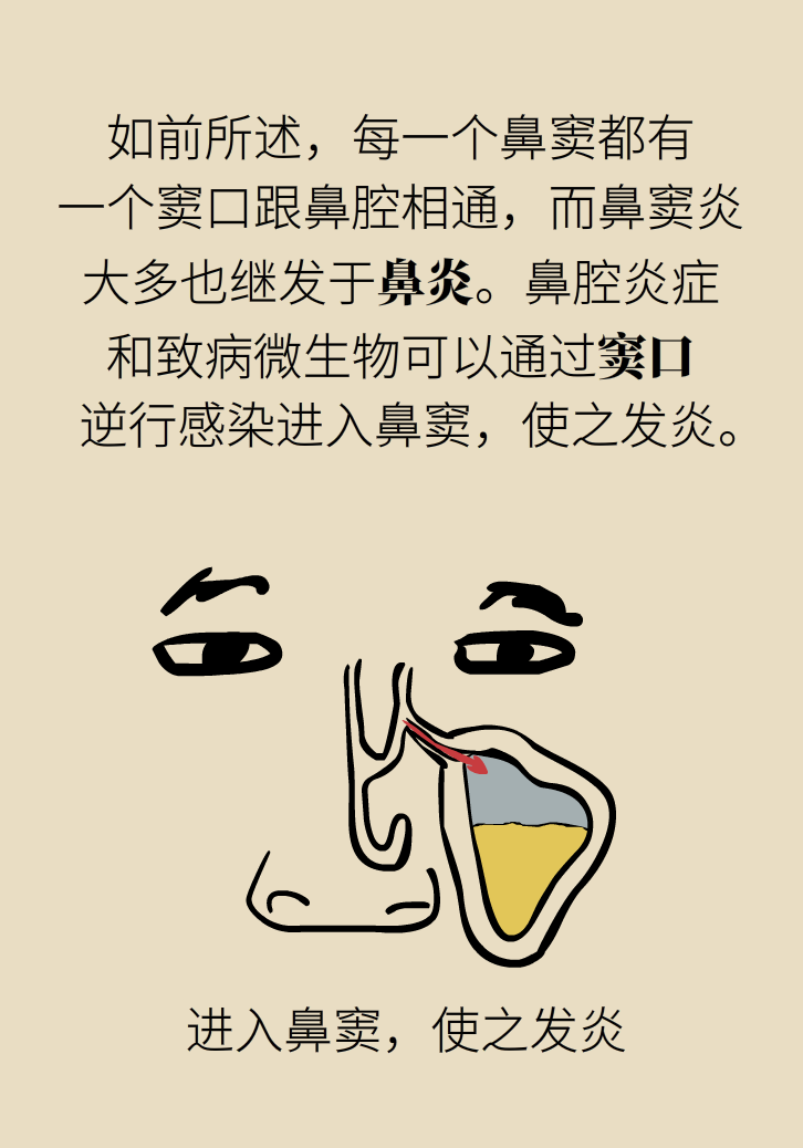 為什么鼻竇發(fā)炎，疼的卻是頭、眼和牙？
