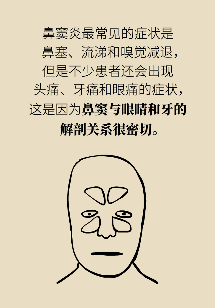 為什么鼻竇發(fā)炎，疼的卻是頭、眼和牙？