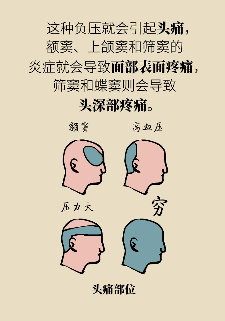 為什么鼻竇發(fā)炎，疼的卻是頭、眼和牙？