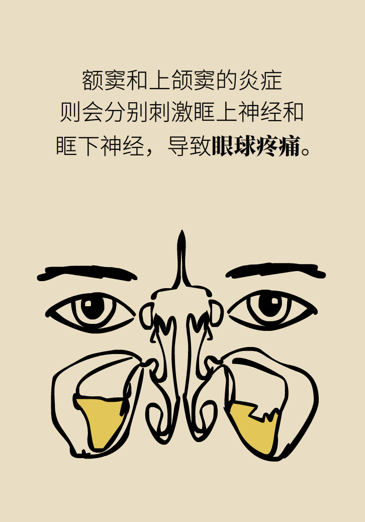 為什么鼻竇發(fā)炎，疼的卻是頭、眼和牙？