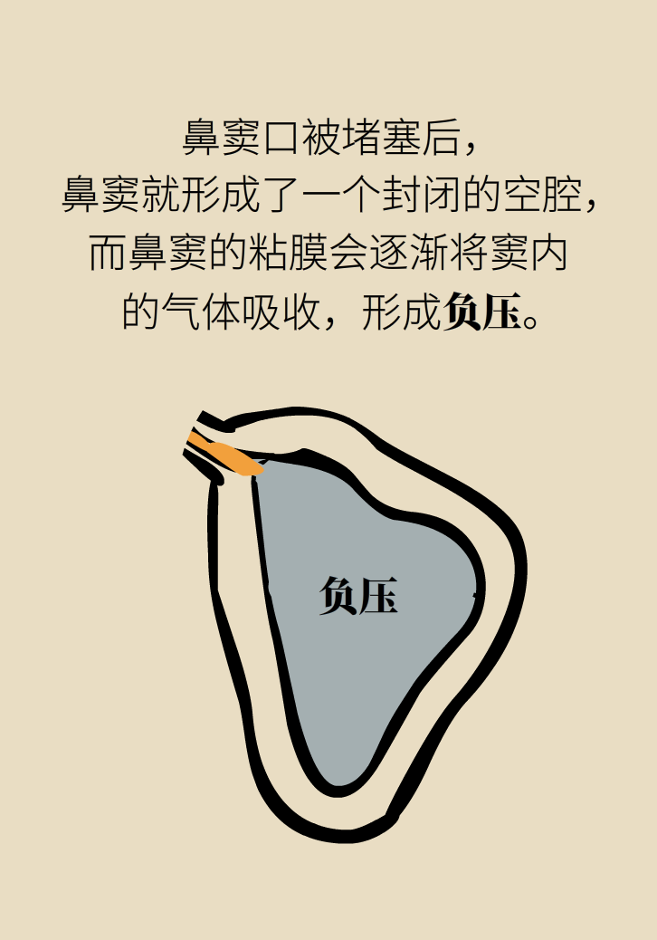 為什么鼻竇發(fā)炎，疼的卻是頭、眼和牙？