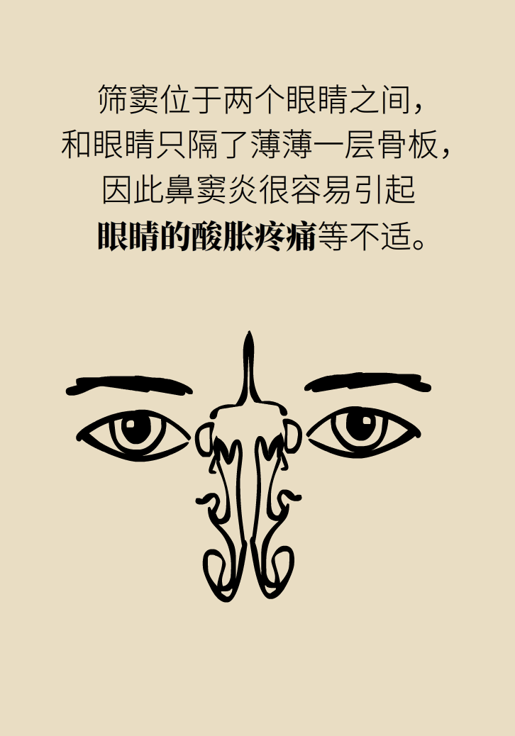 為什么鼻竇發(fā)炎，疼的卻是頭、眼和牙？