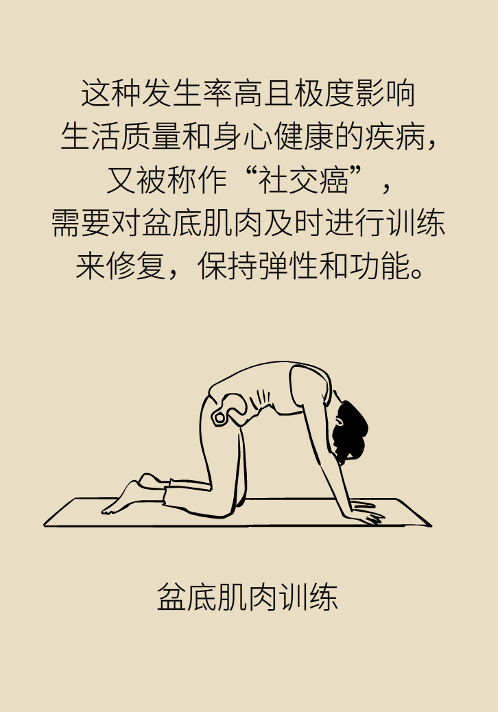 選擇剖腹產(chǎn)，就能避免盆底肌損傷嗎？