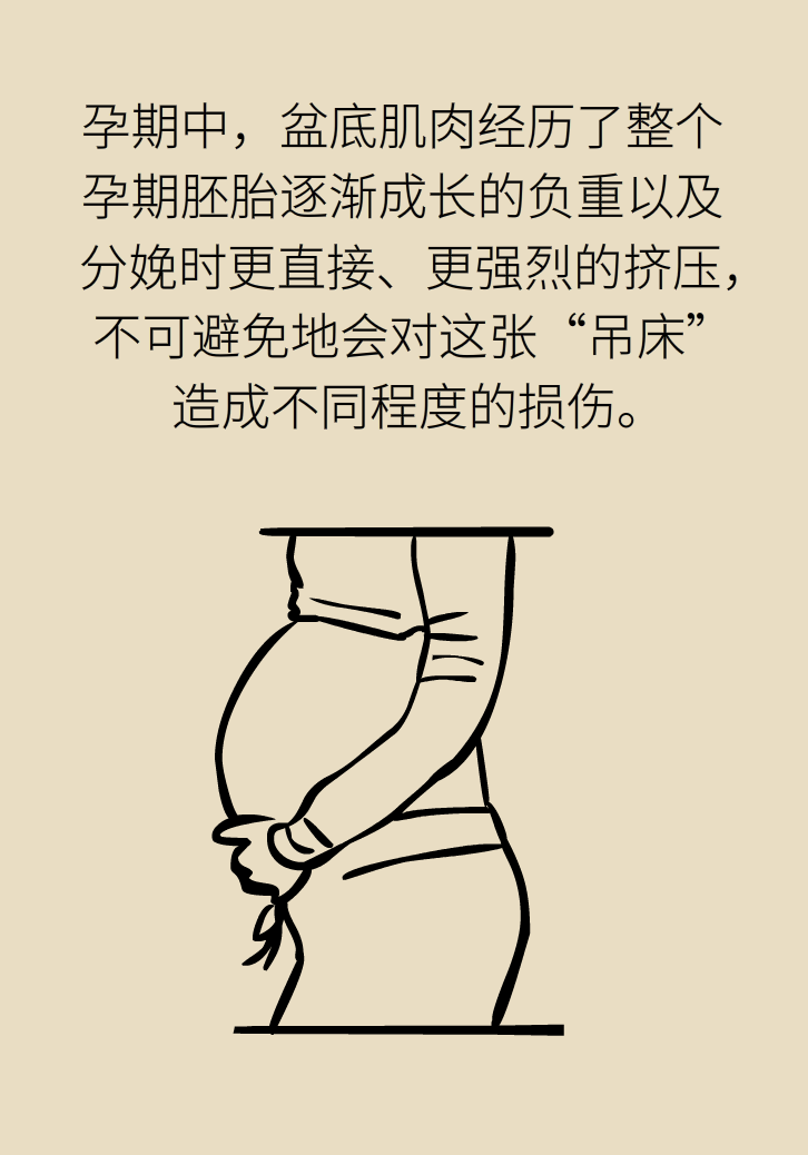 選擇剖腹產(chǎn)，就能避免盆底肌損傷嗎？