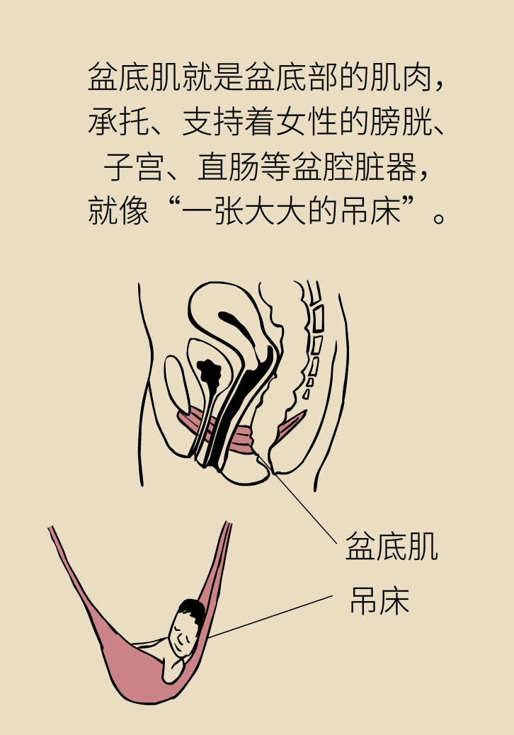 選擇剖腹產(chǎn)，就能避免盆底肌損傷嗎？