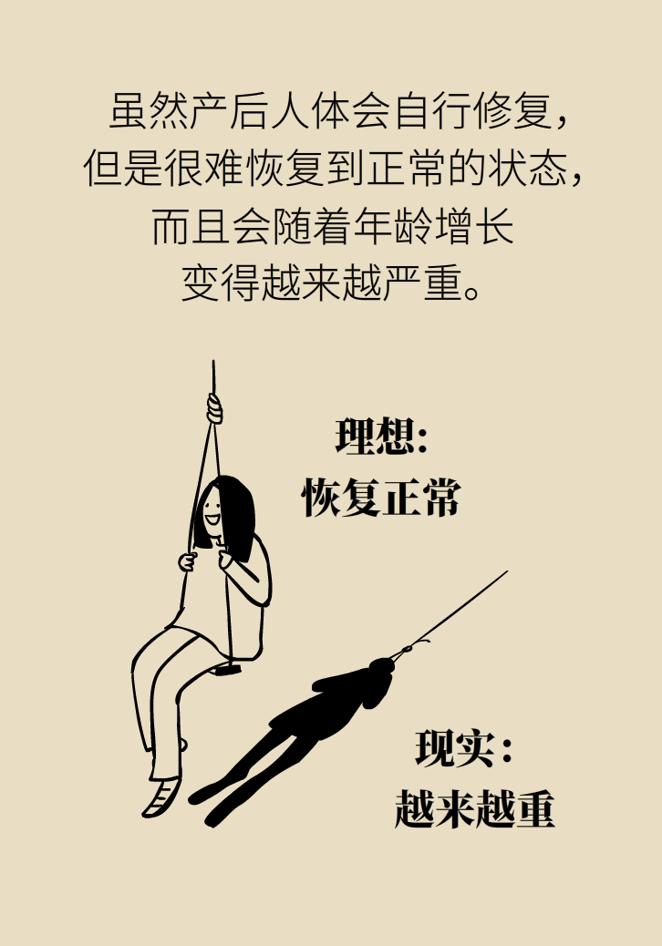 選擇剖腹產(chǎn)，就能避免盆底肌損傷嗎？