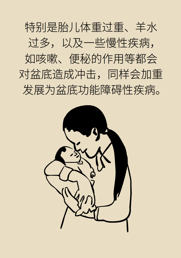 選擇剖腹產(chǎn)，就能避免盆底肌損傷嗎？