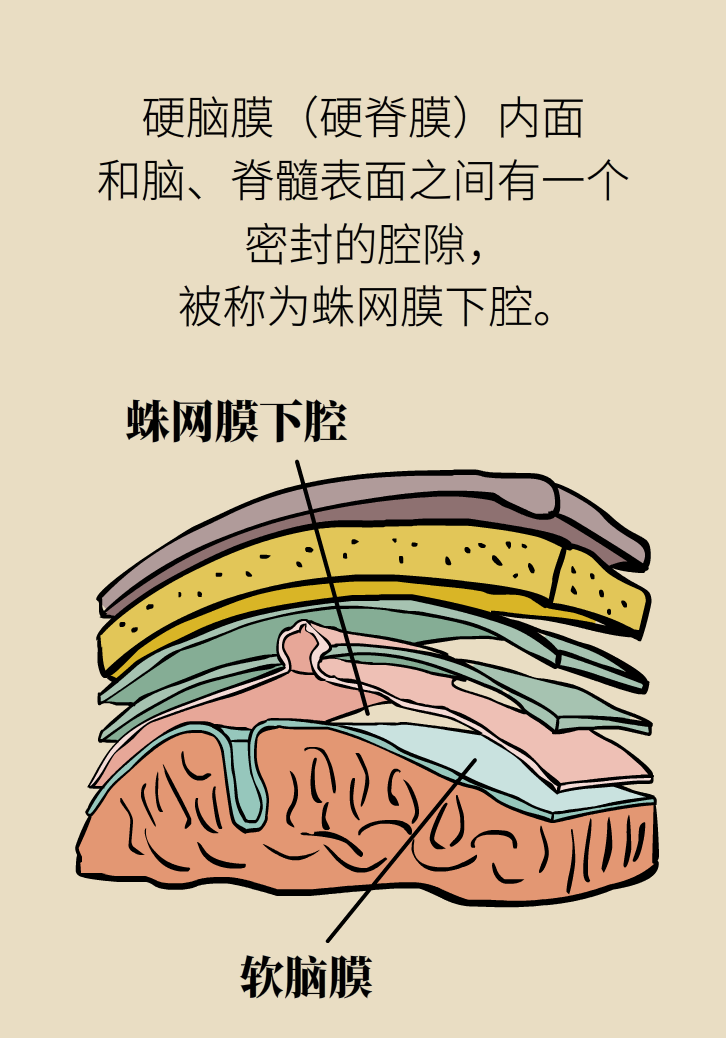 練瑜伽把腦脊液拉漏了！常見的“瑜伽病”你知道多少