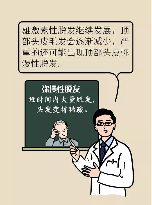 頭發(fā)一把一把地掉？搞明白根源才能對(duì)癥下藥