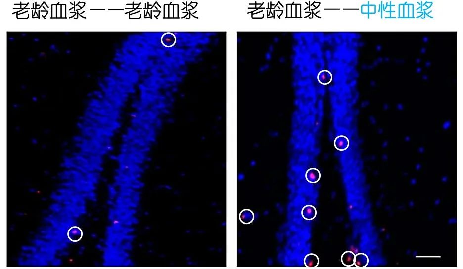 重返年輕不用大換血，只要給血液“兌點(diǎn)水”？