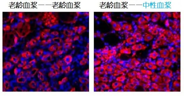 重返年輕不用大換血，只要給血液“兌點(diǎn)水”？