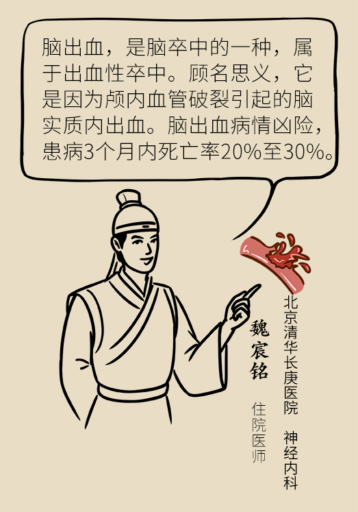 腦出血怎么辦？這些人群要格外注意