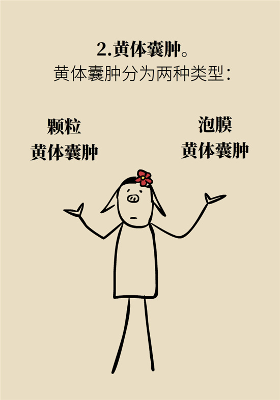 卵巢囊腫科普動漫：卵巢囊腫是腫瘤嗎？要學(xué)會這樣區(qū)分