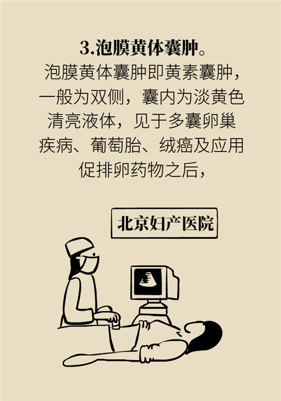 卵巢囊腫科普動漫：卵巢囊腫是腫瘤嗎？要學(xué)會這樣區(qū)分