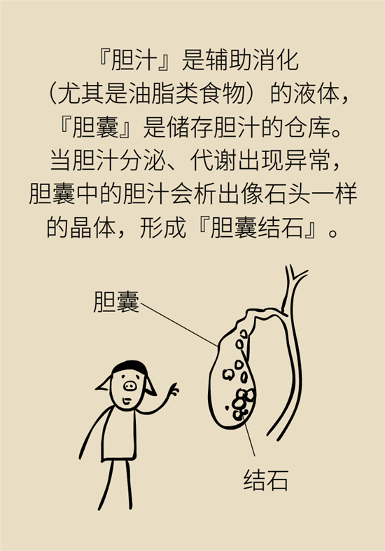 結(jié)石科普：身體里多了各種結(jié)石，應(yīng)該怎么辦？