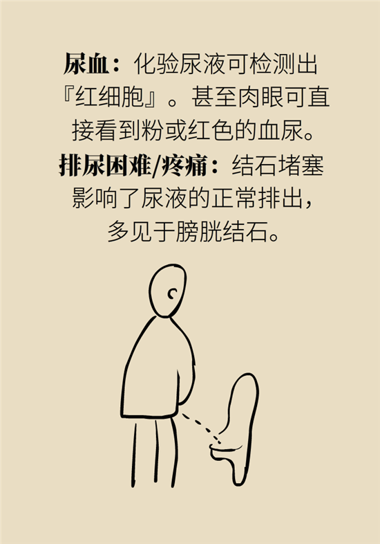 結(jié)石科普：身體里多了各種結(jié)石，應(yīng)該怎么辦？