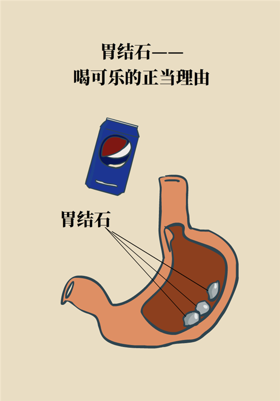 結(jié)石科普：身體里多了各種結(jié)石，應(yīng)該怎么辦？