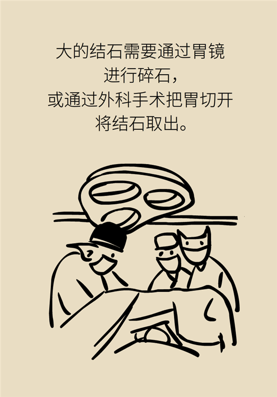 結(jié)石科普：身體里多了各種結(jié)石，應(yīng)該怎么辦？