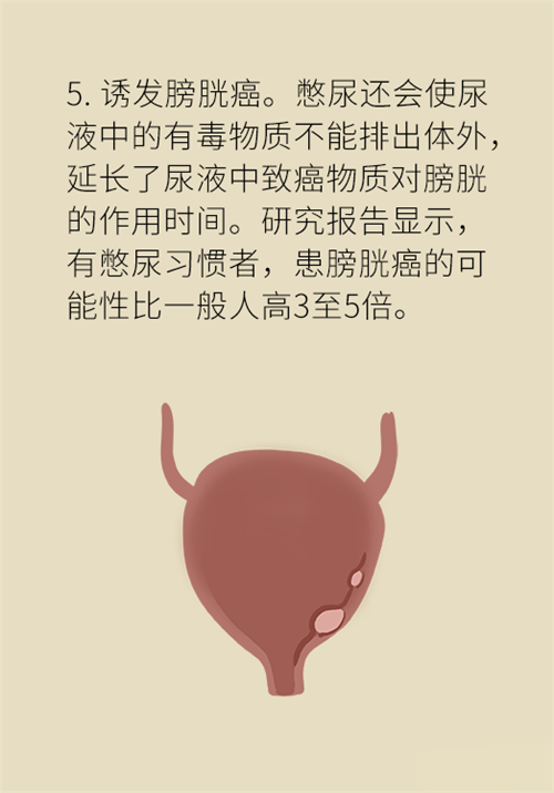 憋尿的7大危害，你真的了解嗎？