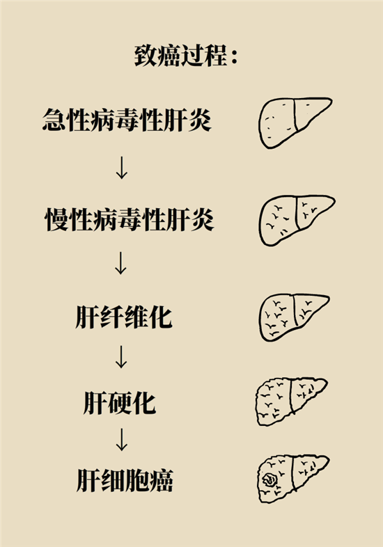 癌癥會傳染嗎？專家：這些高危因素得注意