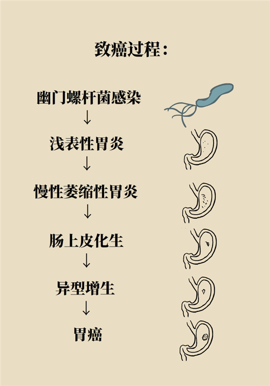 癌癥會傳染嗎？專家：這些高危因素得注意
