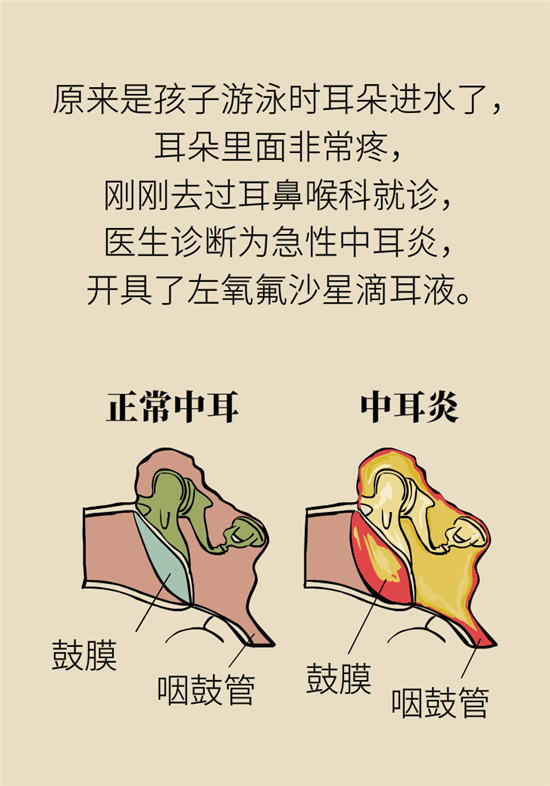 孩子游泳耳朵進(jìn)水用“耳浴“？得注意這7大細(xì)節(jié)