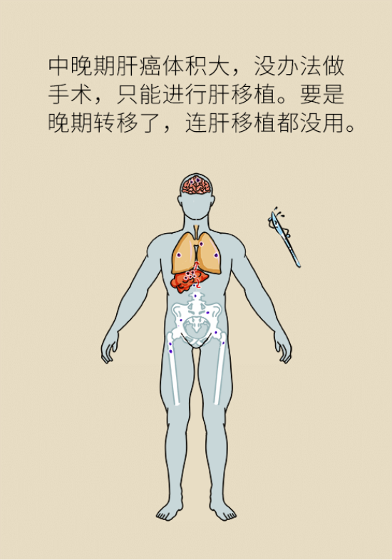 論發(fā)現(xiàn)早期肝癌的本事，cfDNA比AFP更精準(zhǔn)，比影像學(xué)更早一步