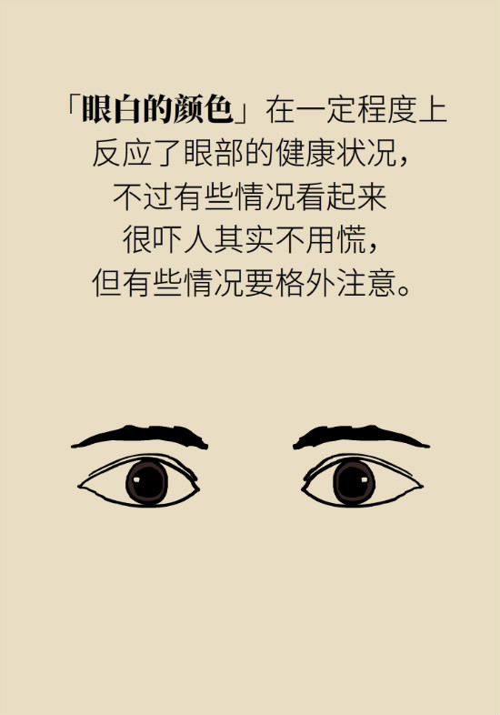 眼白有斑塊、出血要緊嗎？專家：名字唬人但問題不大