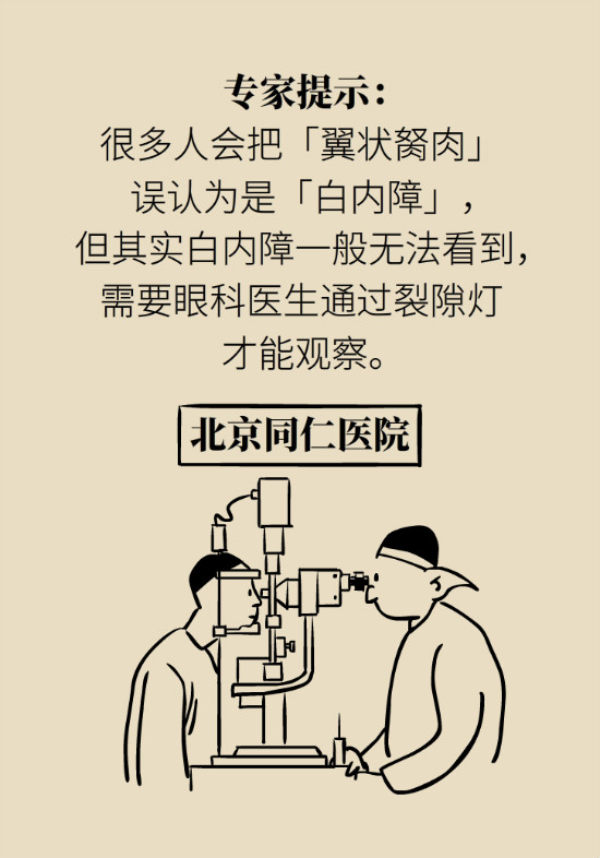 眼白有斑塊、出血要緊嗎？專家：名字唬人但問題不大