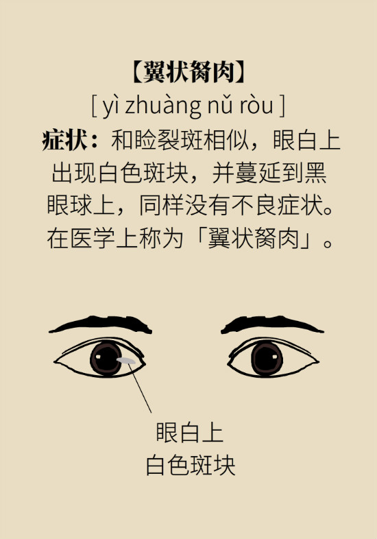 眼白有斑塊、出血要緊嗎？專家：名字唬人但問題不大