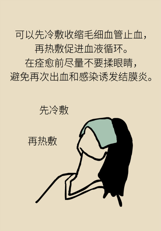 眼白有斑塊、出血要緊嗎？專家：名字唬人但問題不大