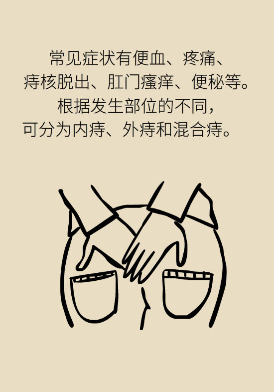 長“痔”如何久安？專家的建議來了