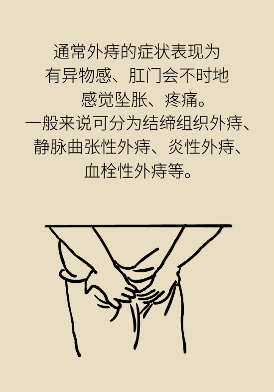 長“痔”如何久安？專家的建議來了