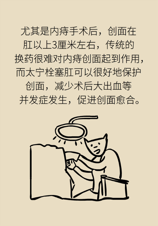 長“痔”如何久安？專家的建議來了
